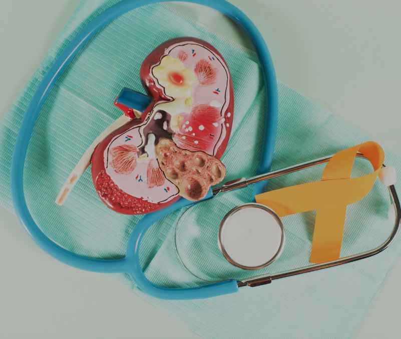 Uro Oncology Mobile